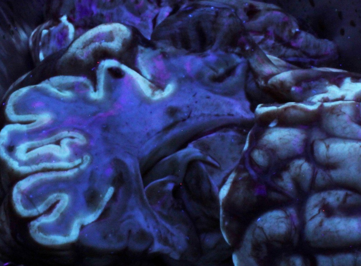  Marked autofluorescence under ultraviolet light in a case of CCN in a calf Source: Rebecca Froehlich-Kelly via National Disease Control Centre