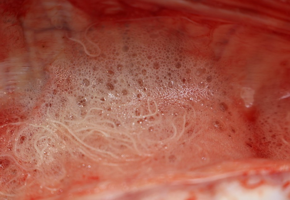 Lungworm mixed with froth in a trachea (Source: AFBI)