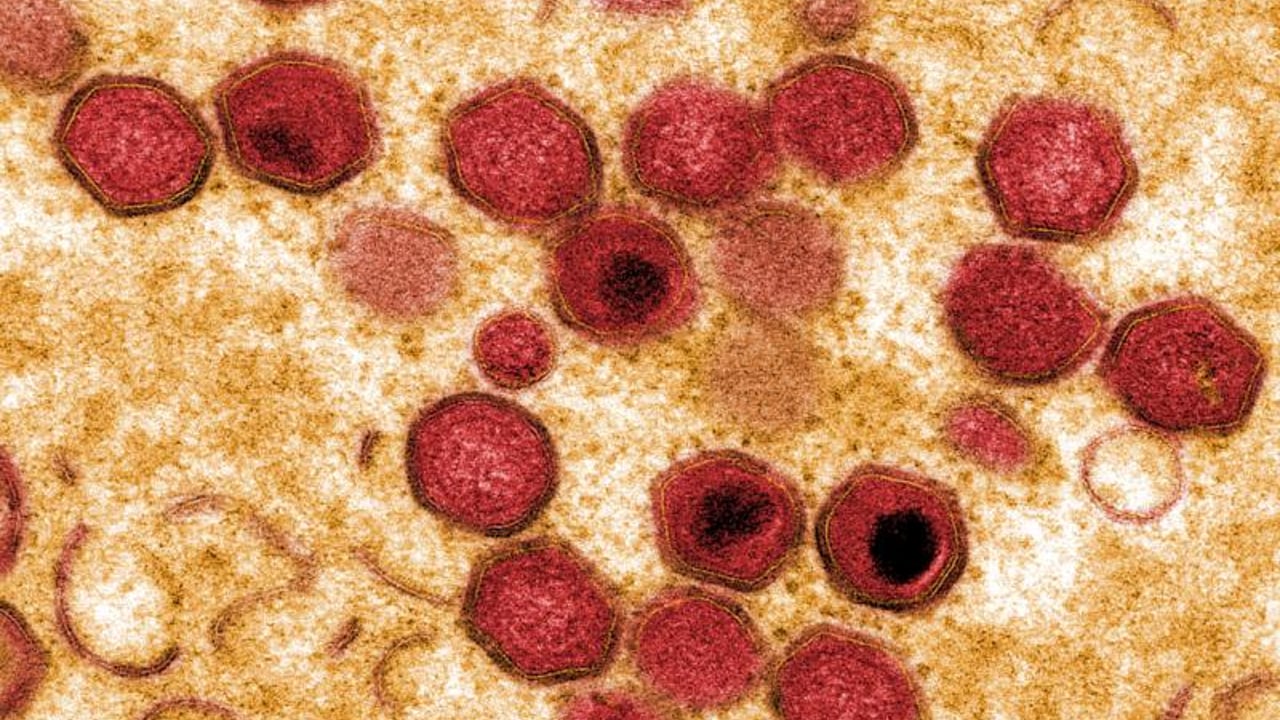 Study finds Pirbright African swine fever vaccine has 100% success rate