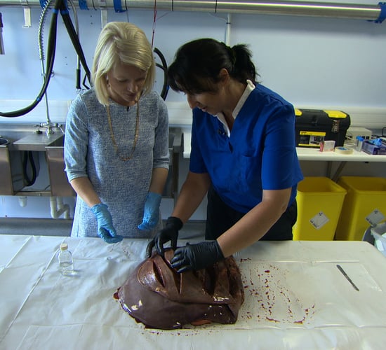 Teagasc liver fluke research to feature on 'The Science Squad'