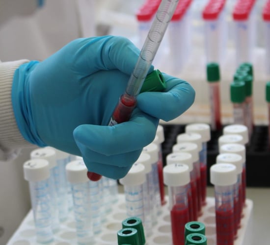 TB steering group meets with CVO to explore eradication policies