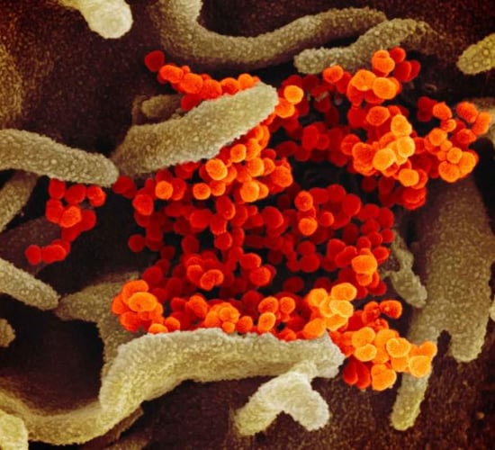 Pirbright begins testing potential Covid-19 vaccines on animals