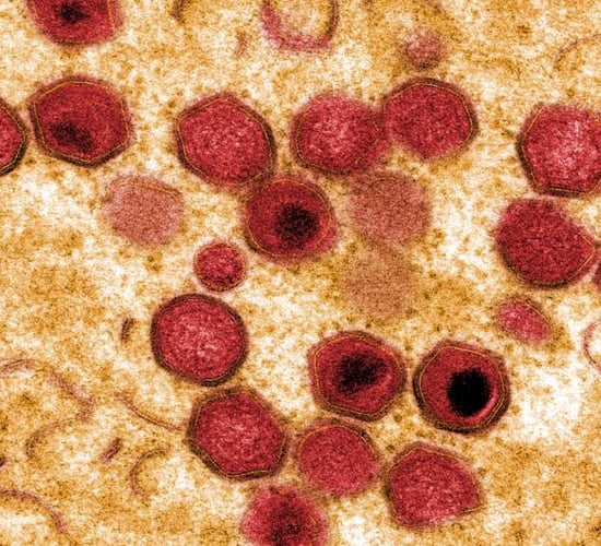 Study finds Pirbright African swine fever vaccine has 100% success rate