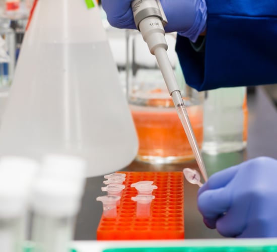 SIPTU: Government 'should be ready' for increasing Covid-19 testing capacity in meat plants