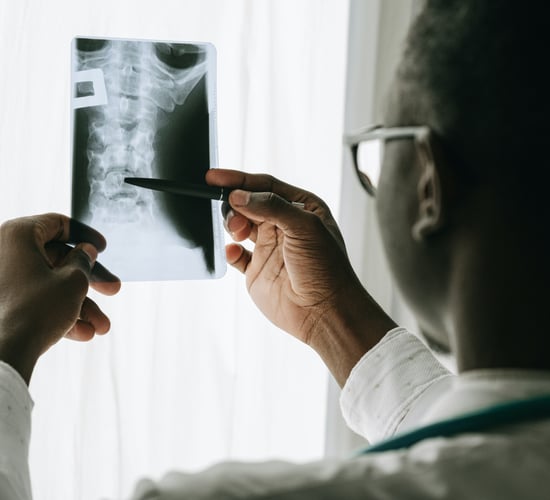 Vegans at higher risk of bone fractures - Oxford study