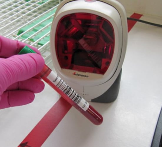 UK government to establish specialist TB interferon-gamma testing lab