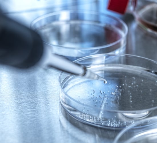 Second case of foot-and-mouth disease in Germany ruled out