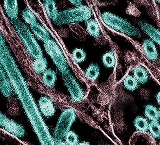Harvard scientists warn of bird flu pandemic