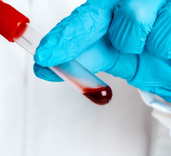 DAFM data shows more TB reactors identified in Cork than any other county