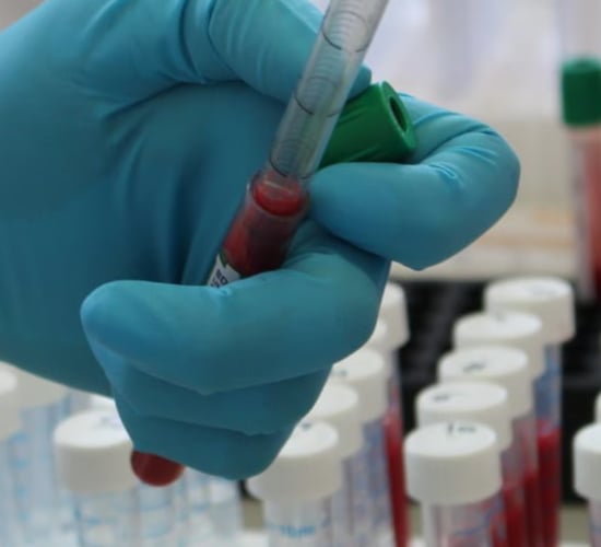 Kilmoon Barndance Xmas raffle raising funds for cancer research