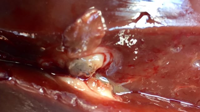 Revealed: Which county has the worst liver fluke record