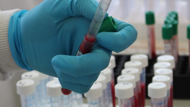 TB steering group meets with CVO to explore eradication policies
