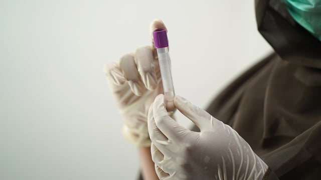 Teagasc's role in fighting Covid-19: Samples, sequencing and making sense of the situation