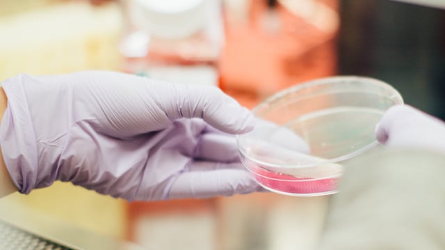 Teagasc researching use of bacterial viruses in securing future of food production
