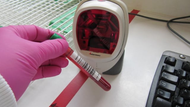 UK government to establish specialist TB interferon-gamma testing lab