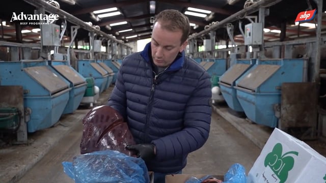 Video: Vet shows damage caused by liver fluke in cattle