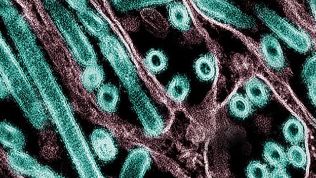 Harvard scientists warn of bird flu pandemic