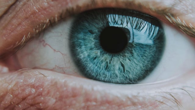 Farmers may be at higher risk of developing glaucoma - specialist