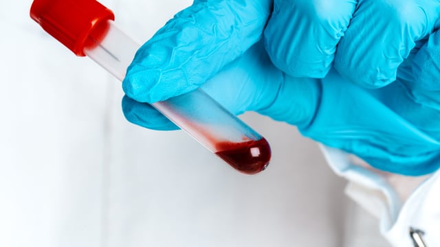 DAFM data shows more TB reactors identified in Cork than any other county